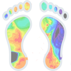 Plantare ortopedico e dinamico Giuliani: Impronta del piede